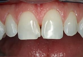 Smile Care Dental Group | Orthodontics, Ceramic Crowns and Dental Fillings