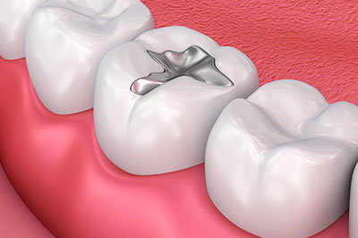 Smile Care Dental Group | Aesthetics, Periodontal Treatment and Oral Exams