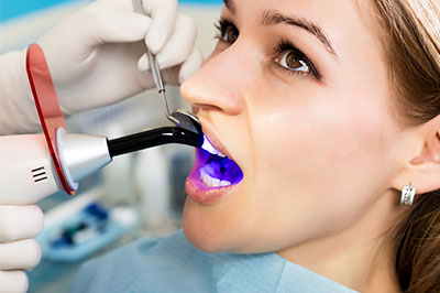 Smile Care Dental Group | Veneers, Root Canals and Pediatric Dentistry