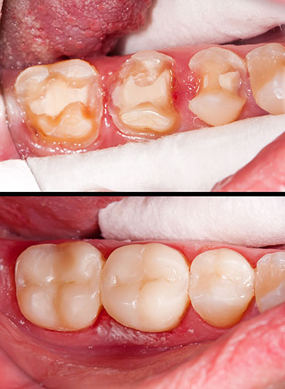 Smile Care Dental Group | Pediatric Dentistry, Dental Fillings and Digital Radiography