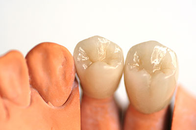 Smile Care Dental Group | Extractions, Root Canals and Dentures
