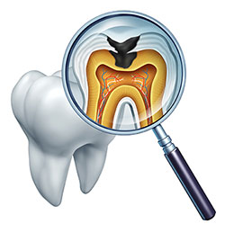 Smile Care Dental Group | Dental Bridges, Preventative Program and Oral Surgery