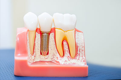 Smile Care Dental Group | Aesthetics, Periodontal Treatment and Oral Surgery