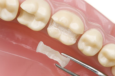 Smile Care Dental Group | Oral Exams, Root Canals and Braces