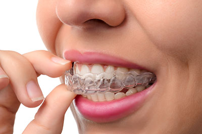 Smile Care Dental Group | Dental Bridges, TMJ Disorders and Invisalign&reg;