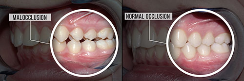 Smile Care Dental Group | Laser Dentistry, Preventative Program and Periodontal Treatment