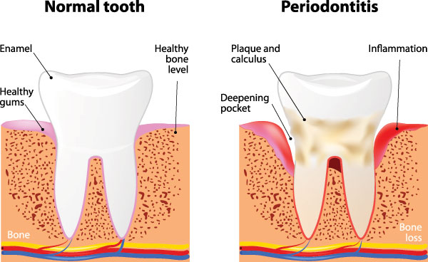 Smile Care Dental Group | Periodontal Treatment, Emergency Treatment and Pediatric Dentistry