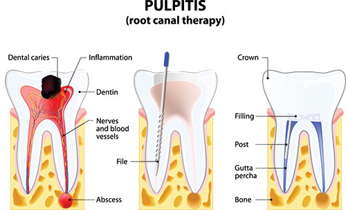 Smile Care Dental Group | Orthodontics, Aesthetics and Fluoride Treatment