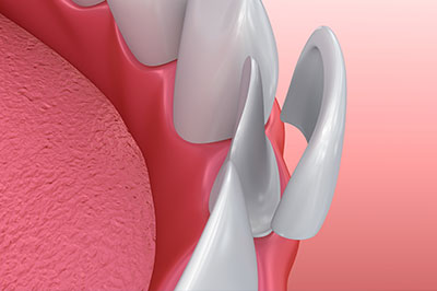 Smile Care Dental Group | Oral Surgery, Ceramic Crowns and Sedation Dentistry