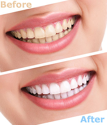 Smile Care Dental Group | Invisalign&reg;, Periodontal Treatment and Emergency Treatment